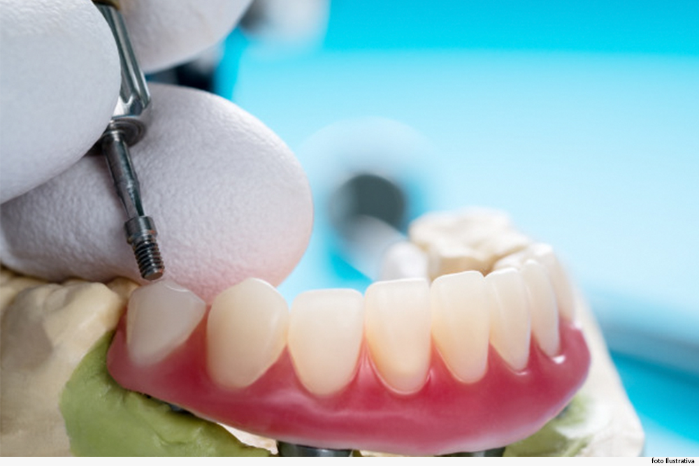 Mão enluvada mexe em dente em modelo de arcada dentária