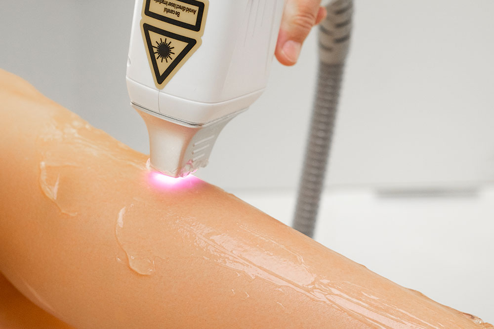 Not-2----Depilacao-a-laser.jpg