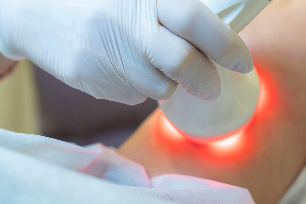 Not-3---Decisao-Tratamento-a-Laser.jpg