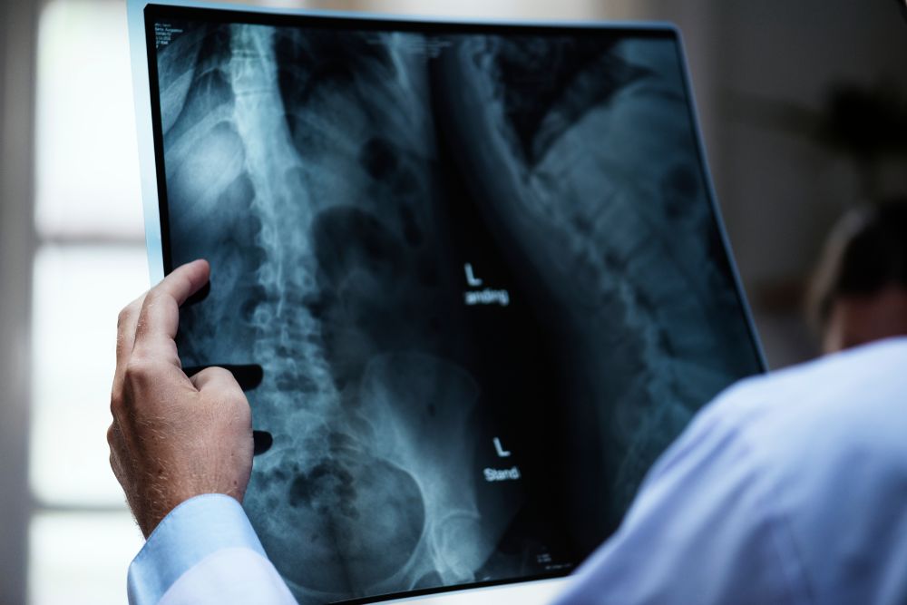 not radiografia raio x.jpg