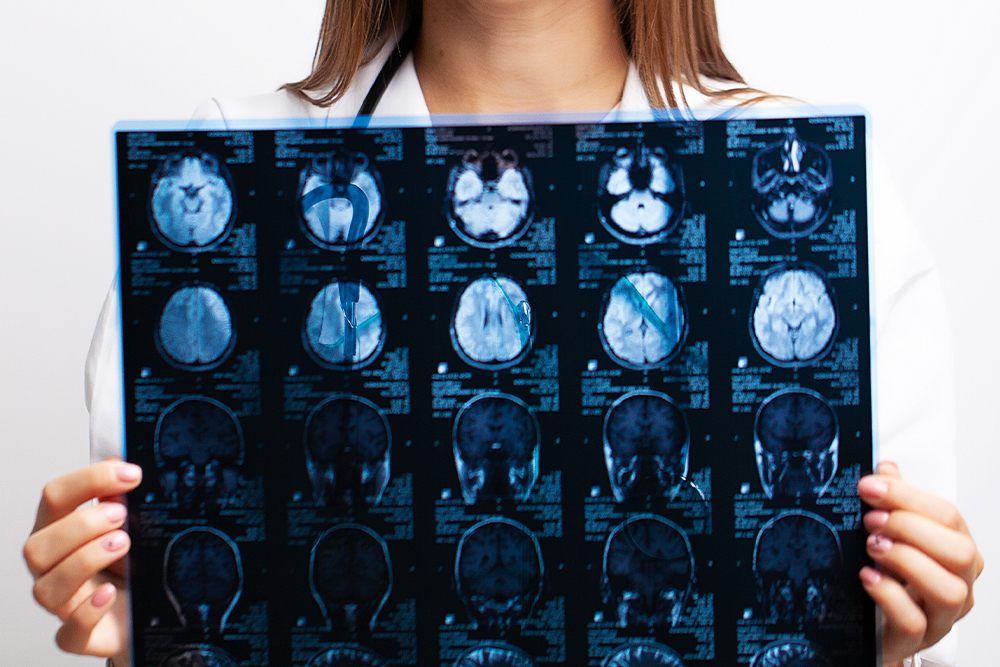 Not 1 Crianca com ma formacao cerebral.jpg